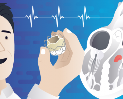 What’s next for Transcatheter Aortic Valve Replacement (TAVR)