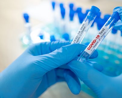 Scaling up for COVID-19 diagnostic testing
