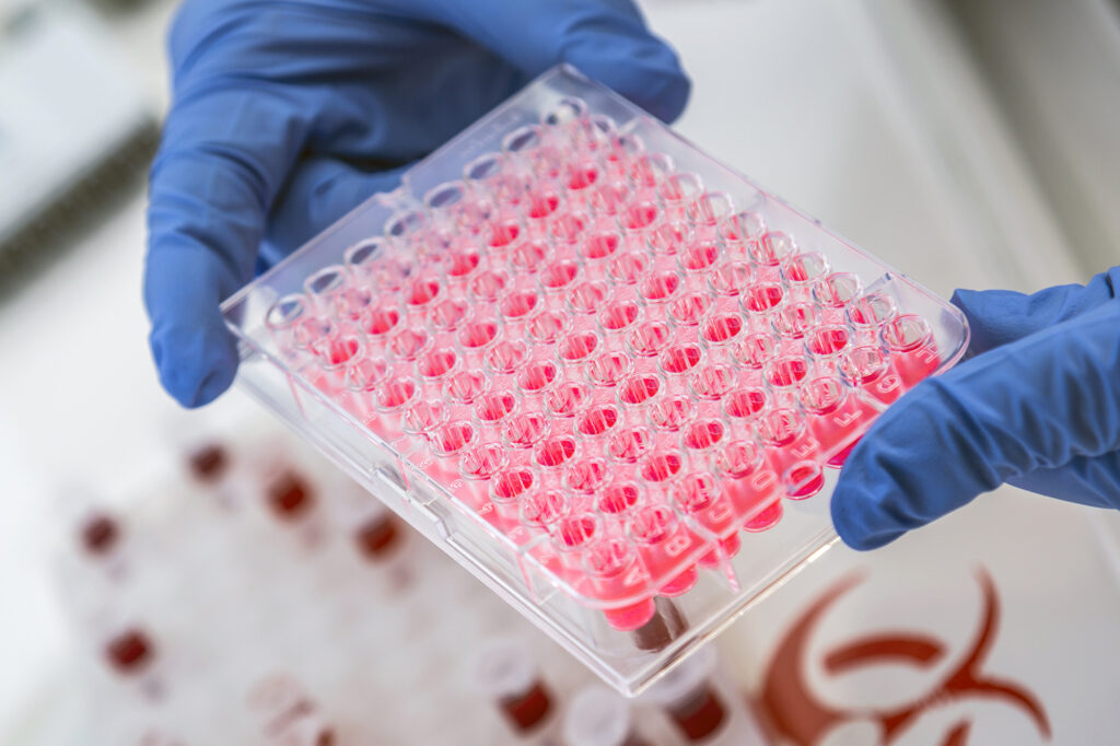 Diagnostic systems evaluation in our CAT-2 lab