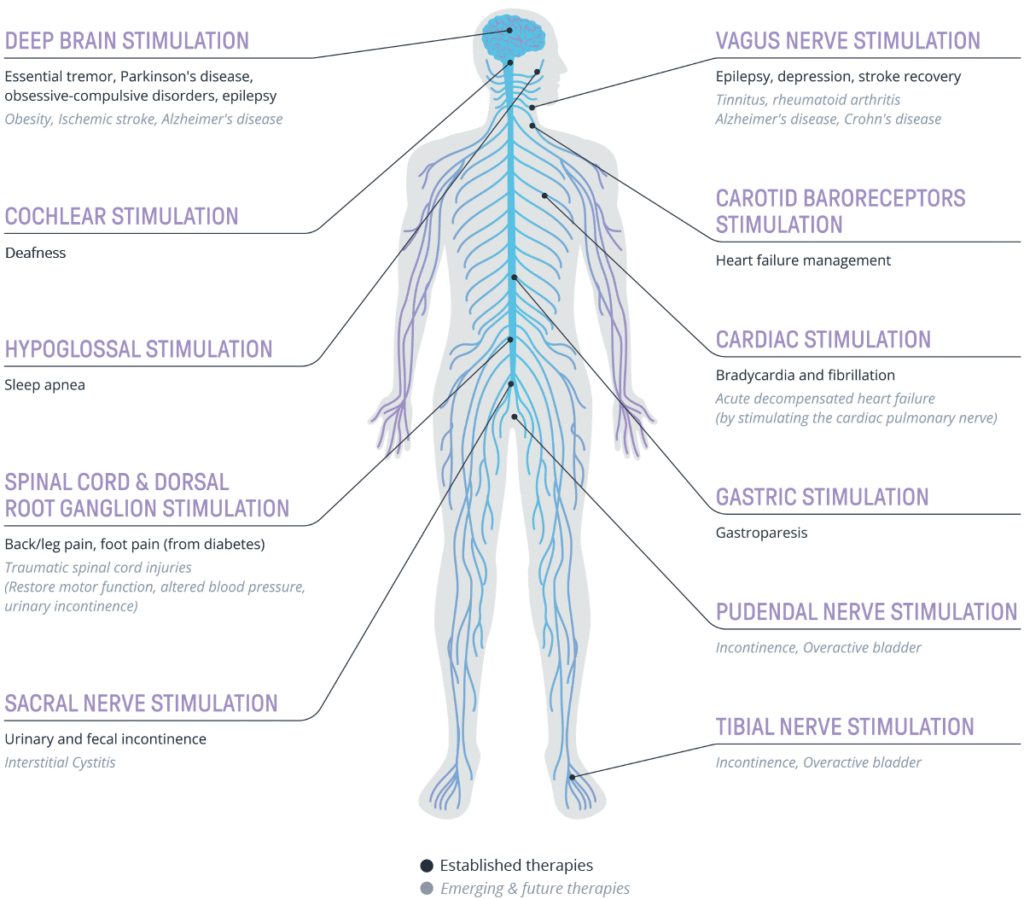 web_inline_Neuromodulation-article-4