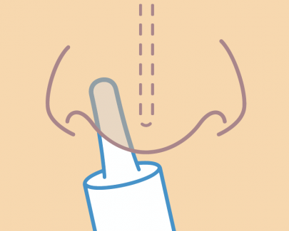 Bespoke device for targeted intranasal delivery
