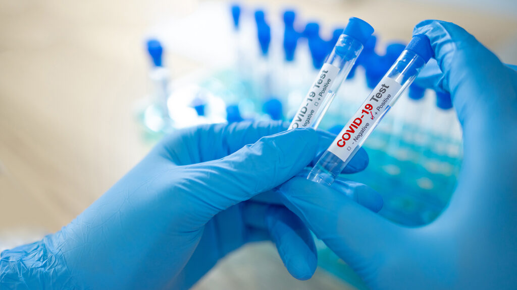 Scaling up for COVID-19 diagnostic testing|