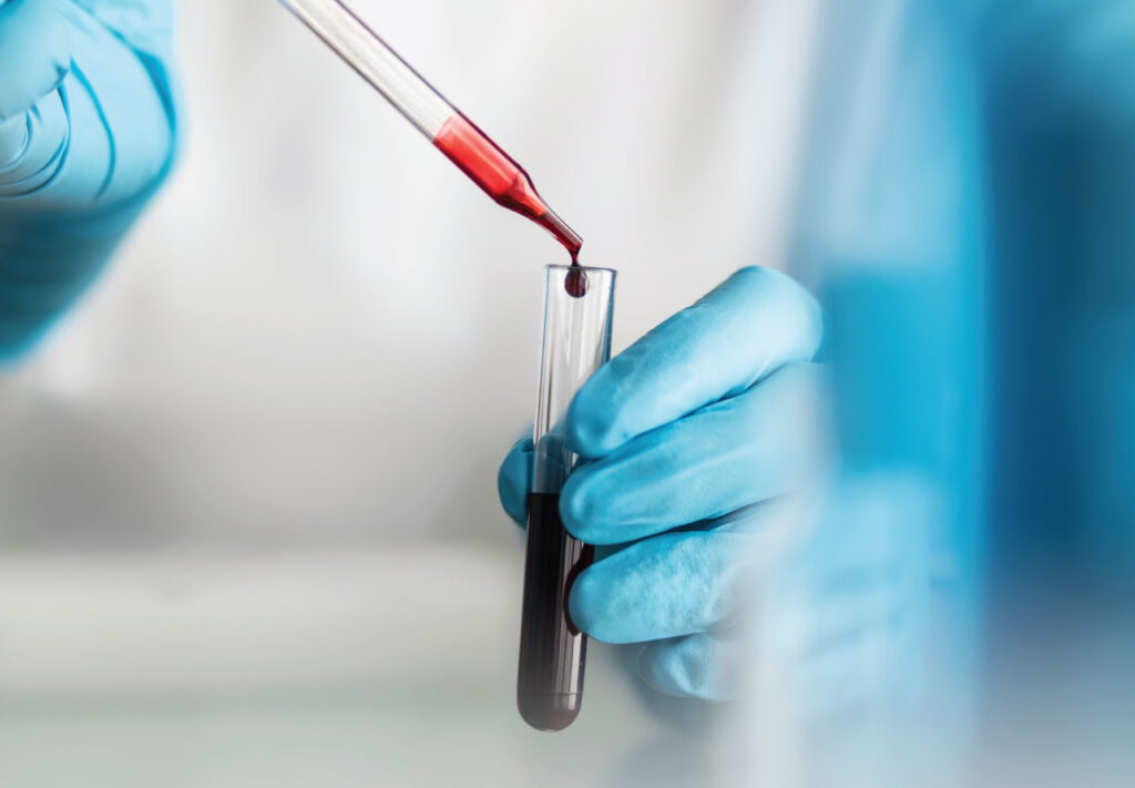 ||CDP whitepaper - Accurately Estimating Blood Loss